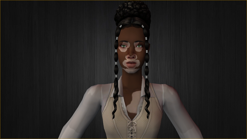 Vitiligo After Model